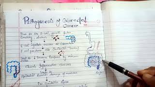 pathogenesis of colorectal cancer NGMedicals [upl. by Hewet690]