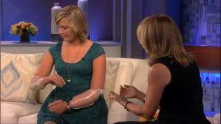 Aimee Copeland Demonstrates How to Use Her Bionic Hands [upl. by Ocinemod]