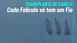 A Ciência por Trás dos Folículos Capilares no transplante capilar [upl. by Annelak]