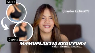 TUDO SOBRE MINHA MAMOPLASTIA REDUTORA COM VÍDEO DE ANTES E DEPOIS [upl. by Fabiano865]