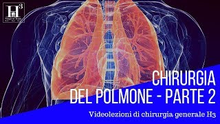 Chirurgia del polmone parte 2  patologie polmonari chirurgiche [upl. by Ccasi]