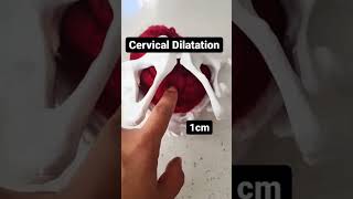 How the cervix dilated Cervical dilation in 20 seconds [upl. by Heisel]