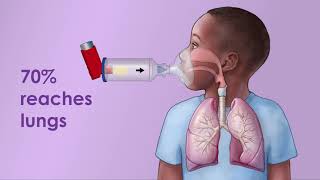 Asthma Inhaler with Spacer [upl. by Onitnevuj]