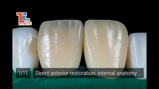 Direct anterior restoration internal anatomy [upl. by Lilak]