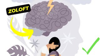 Zoloft How It Works and Its Effects on Your Mental Health [upl. by Cordi]