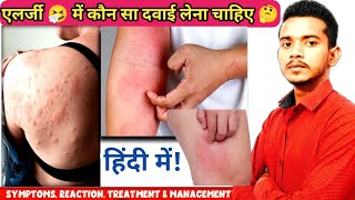 Allergy in hindi  एलर्जी में use होने वाले दवाई 😱  symptoms types  antiallergic medicine [upl. by Notsnorb]