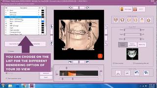 Insights Diagnostic  iRys Software Tutorial Video  Viewing Multiplanar Tab Part 2 [upl. by Nannek394]