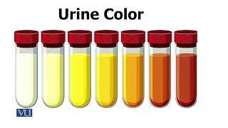 practical Macroscopic Analysis of Urine  Biochemistry II  BIO506PTopic009 [upl. by Aenel783]