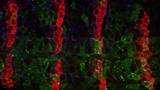 Adenomatous polyposis coli tumour suppressor [upl. by Loy]