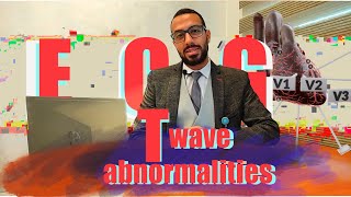 ECG 7 T wave abnormalities تفسير رسم القلب [upl. by Jollanta235]