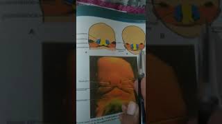 Face embryology  revision based [upl. by Odlo]