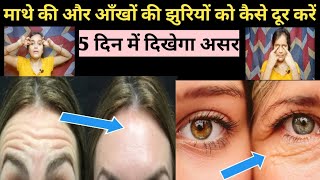 How To Remove Forehead amp Eye Wrinkles ❓️माथे और आंखों की झुर्रियां 5 दिन में गायब करने का सरल तरीका [upl. by Eatnwahs]