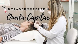 Meu tratamento capilar para queda de cabelo  Intradermoterapia Capilar [upl. by Artied]