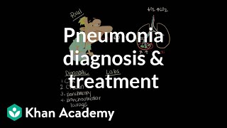 Pneumonia diagnosis and treatment  Respiratory system diseases  NCLEXRN  Khan Academy [upl. by Annirtak]