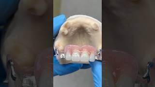 Upper Chrome Cobalt Partial ​⁠EnvisiontecMain envisiontec lsk121shorts dentist dentistteeth [upl. by Alegnatal20]