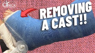 How To Remove a Cast Dr Nick Campitelli [upl. by Valery]