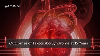 How Is Takotsubo Syndrome Different from a Myocardial Infarction [upl. by Aelam904]