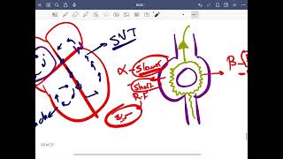 Sick sinus syndrome  WPW [upl. by Leinad257]