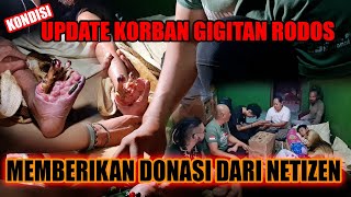 UPDATE SI BAIM KORBAN GIGITAN RODOSRANJAU DARATGIBUG  MEMBERIKAN DONASI DARI NETIZEN [upl. by Ymer]