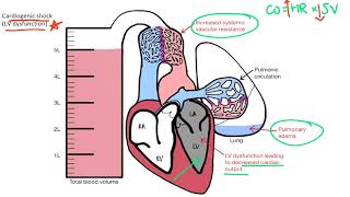 Shock for the USMLE Step 1 [upl. by Annavoig]