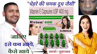 evion 400 for skin  evion 400 capsule for hair  evion 400 khane ke fayde  evion 400 uses in hindi [upl. by Hpotsirhc864]