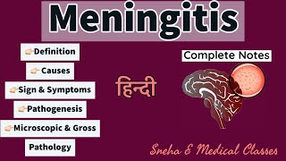 Meningitis Pathology  Hindi  Gross amp Microscopic Pathology  Pathogenesis  Hindi [upl. by Clerk]