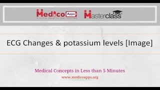 Changes in ECG with potassium levels Image [upl. by Jahdai]