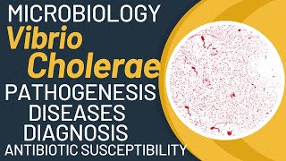 Vibrio cholerae cholera  Vibrio cholerae microbiology  Pathogenesis lab diagnosis [upl. by Yonit]