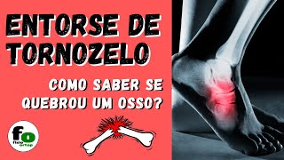 Entorse de tornozelo preciso fazer RX  Regras de Ottawa [upl. by Yknip]