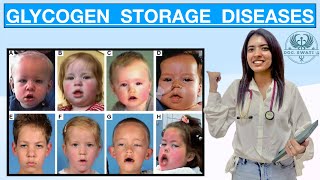 List of Glycogen Storage Diseases  Everyone MUST KNOW    DON’T  MISS [upl. by Elaweda411]