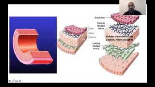 01 Rhumatisme ariculaire aigu Dr M Chettibi  Cardio [upl. by Ttennej]