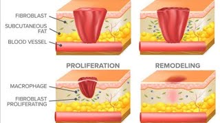 WOUND HEALING [upl. by Zehe]