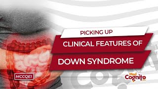 Picking Up Clinical Features of Down Syndrome  MCCQE1 [upl. by Riesman407]