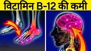 विटामिन B12 की कमी को कैसे ठीक करे  Vitamin B12 Deficiency [upl. by Isabella]