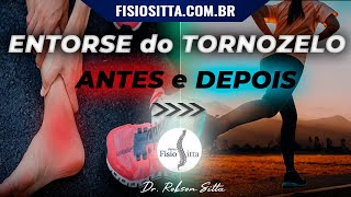 ENTORSE do TORNOZELO LESÃO LIGAMENTAR TRATAMENTO de FISIOTERAPIA Clínica Dr Robson Sitta [upl. by Taft]