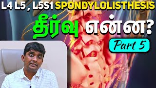 L4 L5  L5S1 Spondylolisthesis தீர்வு என்ன Part 5 Dr Vijayaraghavan  Spine Health Solutions Tamil [upl. by Idid]