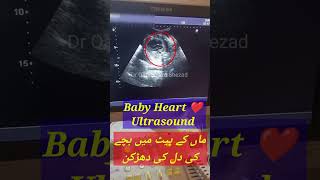 baby heart ultrasound  Dil ki dahrkan [upl. by Yeniar458]