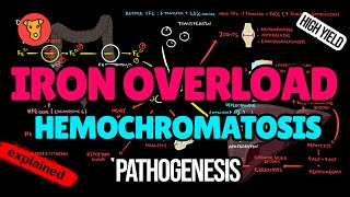 HEMOCHROMATOSIS Pathogenesis Mechanism of clinical symptoms Diagnostic criteria Treatment [upl. by Fowle]