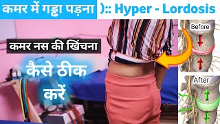 कमर के गड्ढे को कैसे ठीक करें  anterior pelvic tilt Correction exercises  hyperlordosis treatment [upl. by Iadrahc]