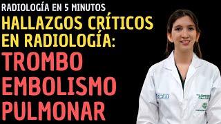 Radiología en 5 minutos Hallazgos críticos en Radiología  Tromboembolismo pulmonar [upl. by Bouley]