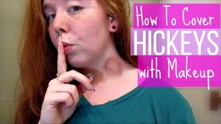 How To Cover Hickeys with Makeup  Lets Talk [upl. by Chassin]