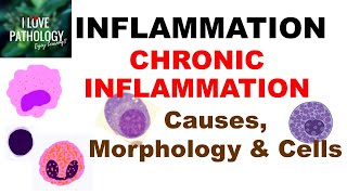 INFLAMMATION 8 CHRONIC INFLAMMATION Causes Morphology amp Cells [upl. by Aihsot]