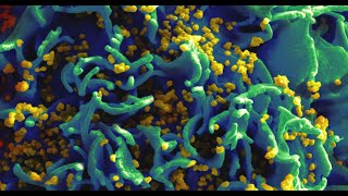 Dioxygendependent Ketolactonases of Pseudomonas putida ATCC 17453 Enigmatic Pioneering Enzymes [upl. by Aenat492]