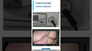 Laparoscopy Camera System [upl. by Aretha728]