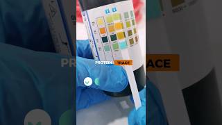 Urine Reagent Strips Sample  urinalysis  laboratory medtechstudent cls mls urinalysis urine [upl. by Arinayed]