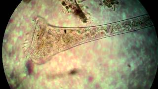 Protist under the microscope [upl. by Misa939]