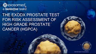 The ExoDx Prostate test for Risk Assessment of high grade prostate cancer HGPCa [upl. by Asel]