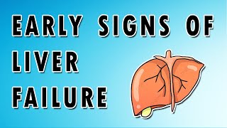 Symptoms of Liver Failure [upl. by Seravat]