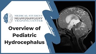 Overview of Pediatric Hydrocephalus [upl. by Wilmette]