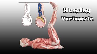 top 6 varicocele yoga exercises for men [upl. by Ayenet296]